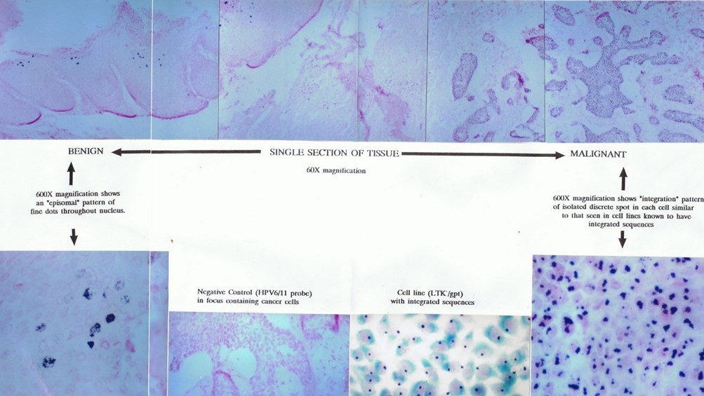 Digene tissue samples